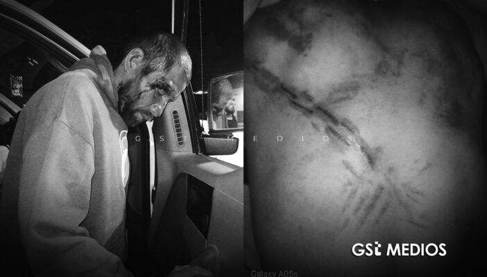 Denuncian presunta agresión de militares contra un hombre con discapacidad en Mascota