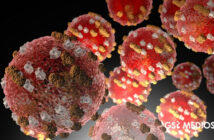 Sarampión continúa en México: ya está presente en 433 municipios